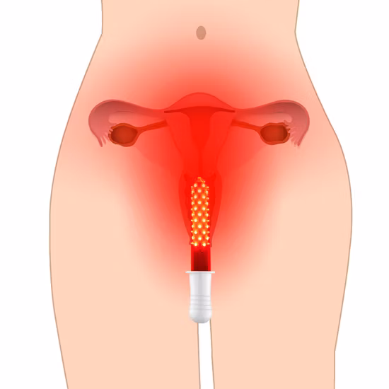 Hnc Gynaecology Red Light Therapy Instrument