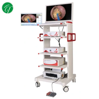 Set completo endoscopio urologico, telecamera per cistoscopio urologico, attrezzatura endoscopica